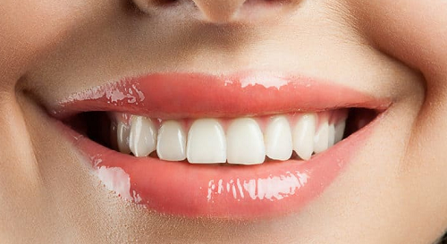 Hàm răng đều đẹp góp phần mang đến nụ cười duyên 