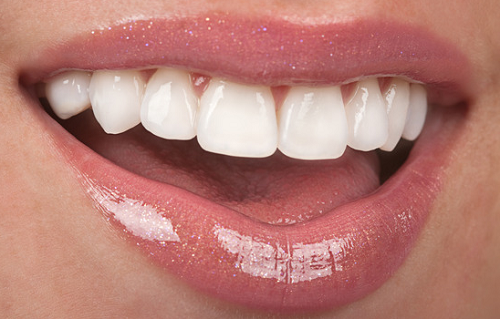Làm răng sứ nguyên hàm – 3 lưu ý sau khi bọc sứ nguyên hàm