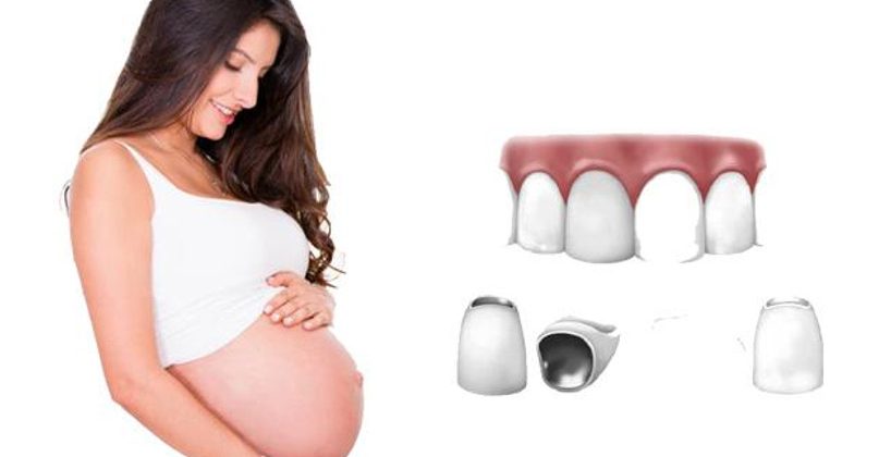 Bọc răng sứ khi mang thai có ảnh hưởng đến sức khoẻ bà bầu và thai nhi không?