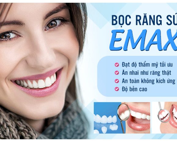 Những thông tin về răng sứ và bọc răng sứ EMAX có thể bạn chưa biết