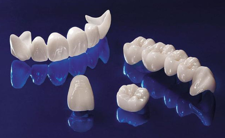 Tìm hiểu thông tin về 2 loại răng toàn sứ EMAX Press và Zirconia