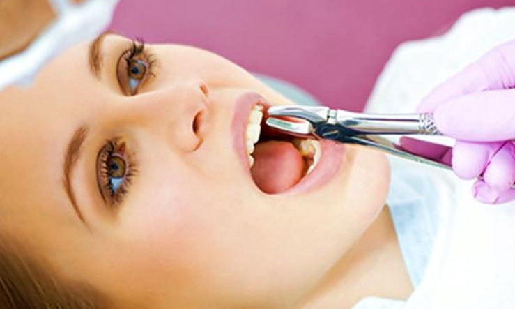 Đi nhổ răng tại những phòng khám uy tín