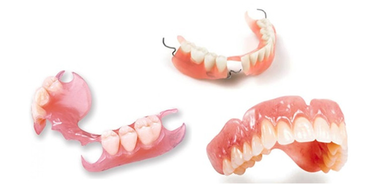 Răng giả tháo lắp bằng nhựa dẻo được nhiều khách hàng lựa chọn